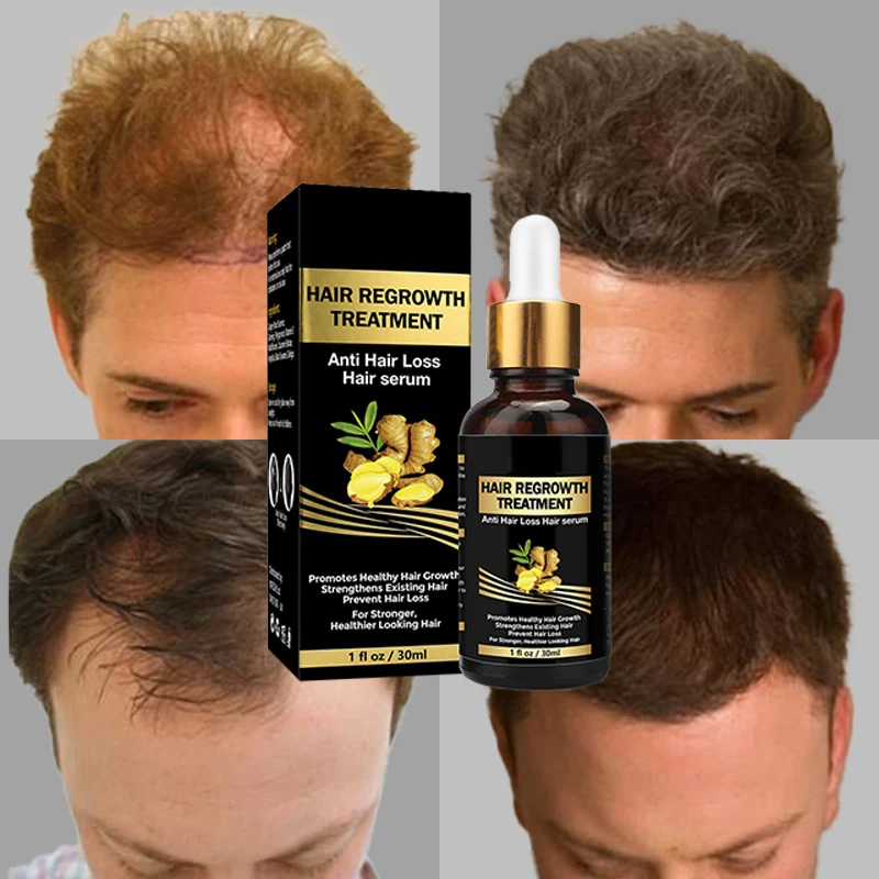 Free Sample OEM/ODM Natural Organic Oil Essential Biotin Serum Hair Growth Oil at Home For Men And Women