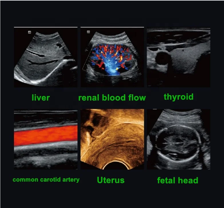 DC- 30 Ultrasound Trolley /Diagnostic Ultrasound Medical Doppler Ultrasound