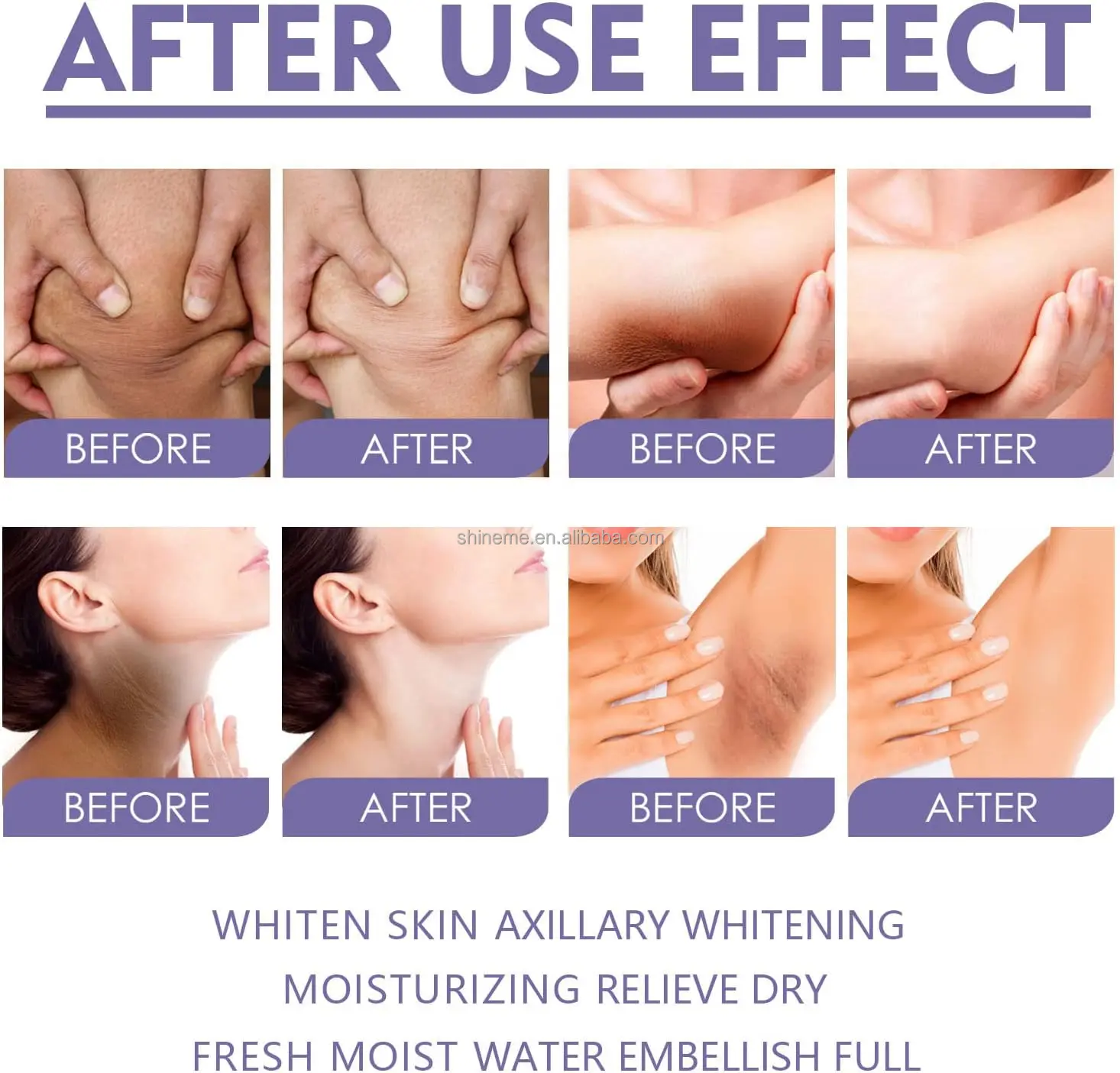 OEM ODM Moisturizes Dark Spot Cream for Knees Elbows Armpit Brightening Deodorant Stick Underarm Whitening Stick