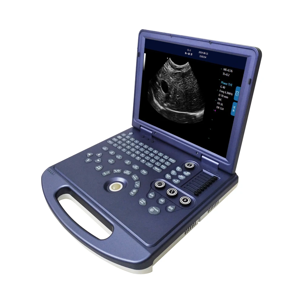 Pc Platform Full Digital Veterinary Black And White Ultrasound Diagnostic System