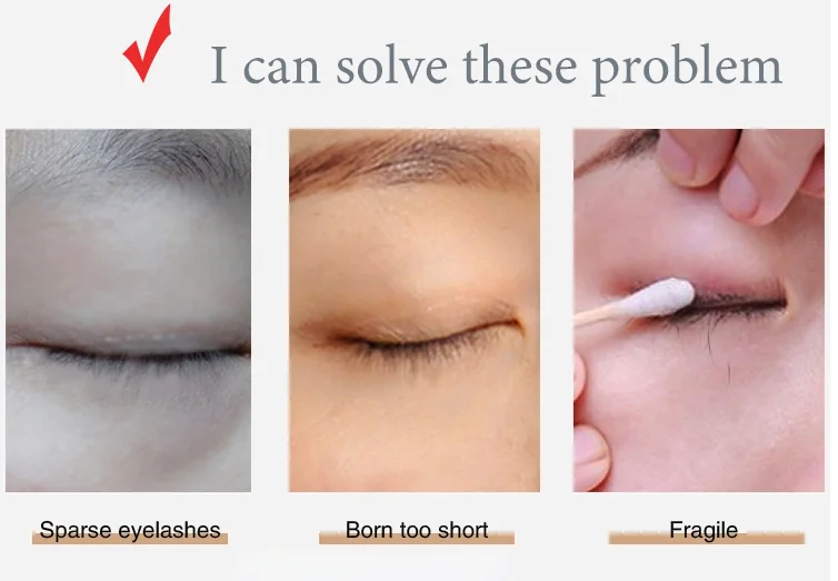 OEM-сервис Лидер продаж сыворотка для роста ресниц kapomi essy