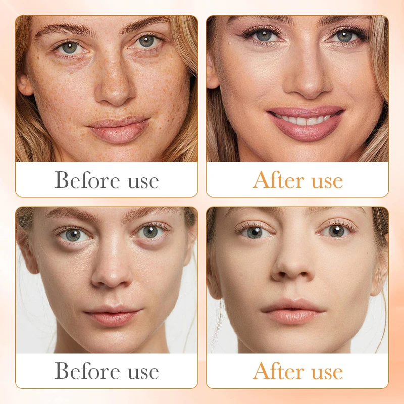 OEM SADOER Women skin care products beauty Whitening Face Serum Solutions Pure Hyaluronic Acid Serum Vitamin C skin care serum
