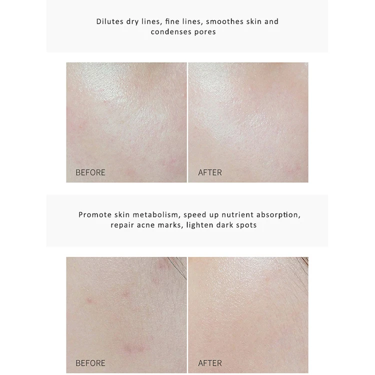 In stock dark spot removing Arbutin beauty whitening cream face and body