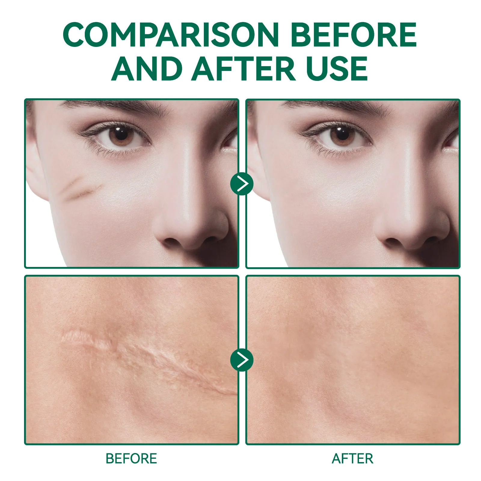ELAIMEI Best Effective Scar Removal Advanced Repair Scar Gel