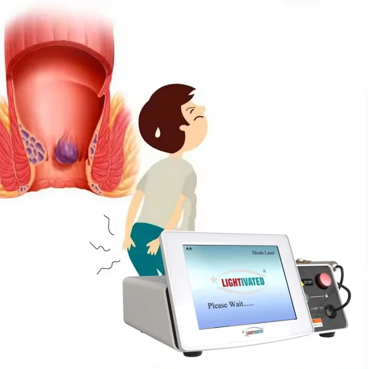 Surgical Laser 980nm Plastic Hemorrhoids Removal Fissure Fistula1470nm Minimal Invasive Surgery Proctology Medical Device