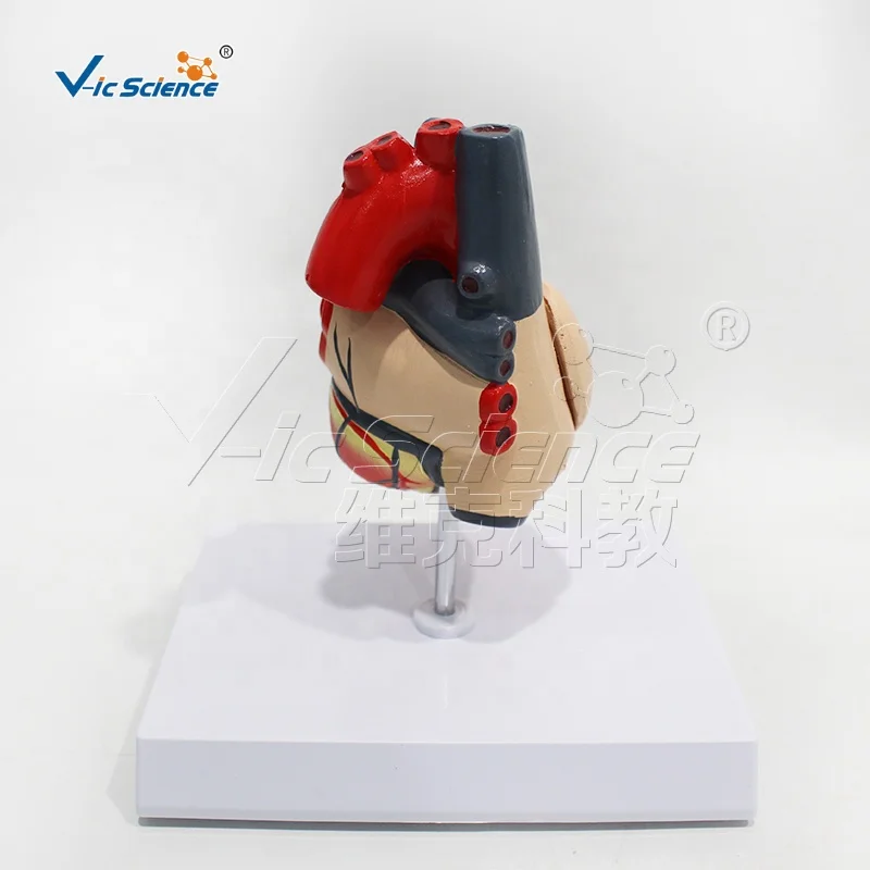 A heart bypass model 4d anatomical assembly model of human organs anatomical human model