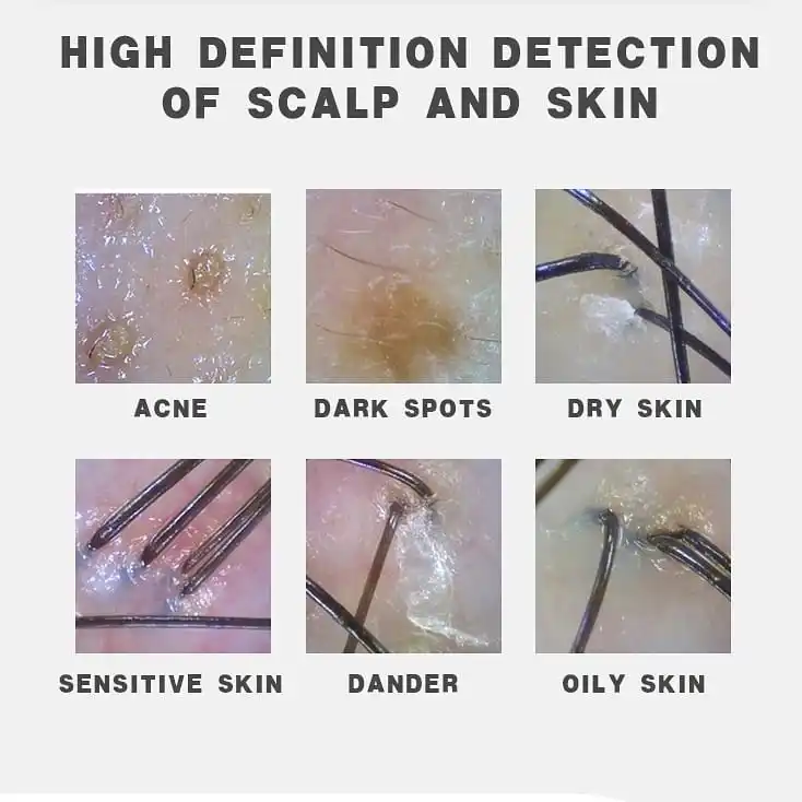 6 в 1 переходная машина analizador лицевая камера Уход за лицом со стразами hydradermabrasion машина с теста кожи