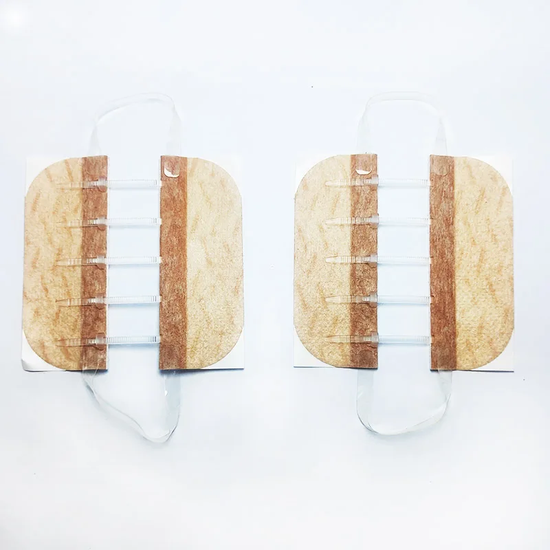 Неинвазивное регулируемое устройство для закрытия ран на молнии с медицинской помощью без келоидного шрама