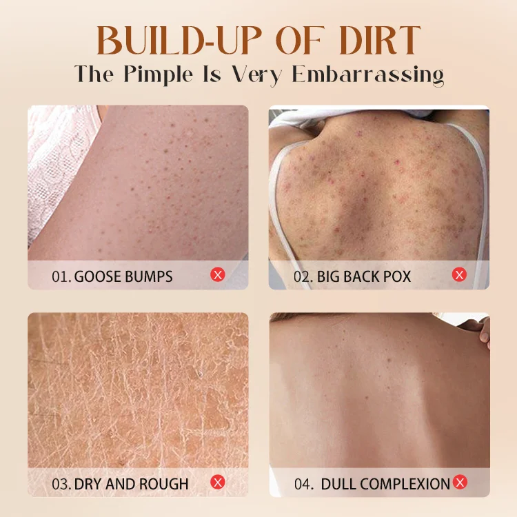 Remove chicken skin body scrub exfoliate body scrub cream private label wholesale organic body scrub private label