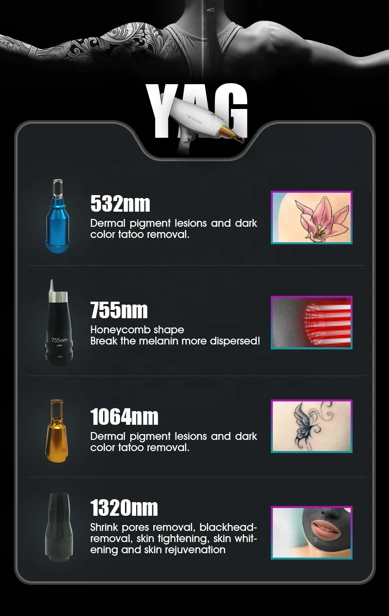 Most advanced ! 2 in 1 nd yag tattoo removal diode laser 808nm laser hair removal machine 755 808nm 1064 for sale factory price