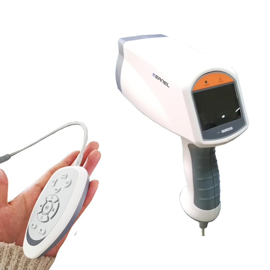Digital HD Video Mini Electronic Colposcope High Definition Camera Digital Colposcope Colposcopy and Biopsy