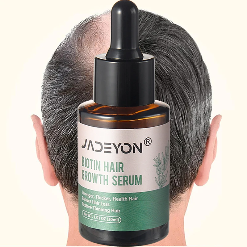 OEM Hair Grow Serum Scalp Oil Organic Natural For Growth Hair Enhance Toughness Regrowth For Men Organic Hair Growth Oil