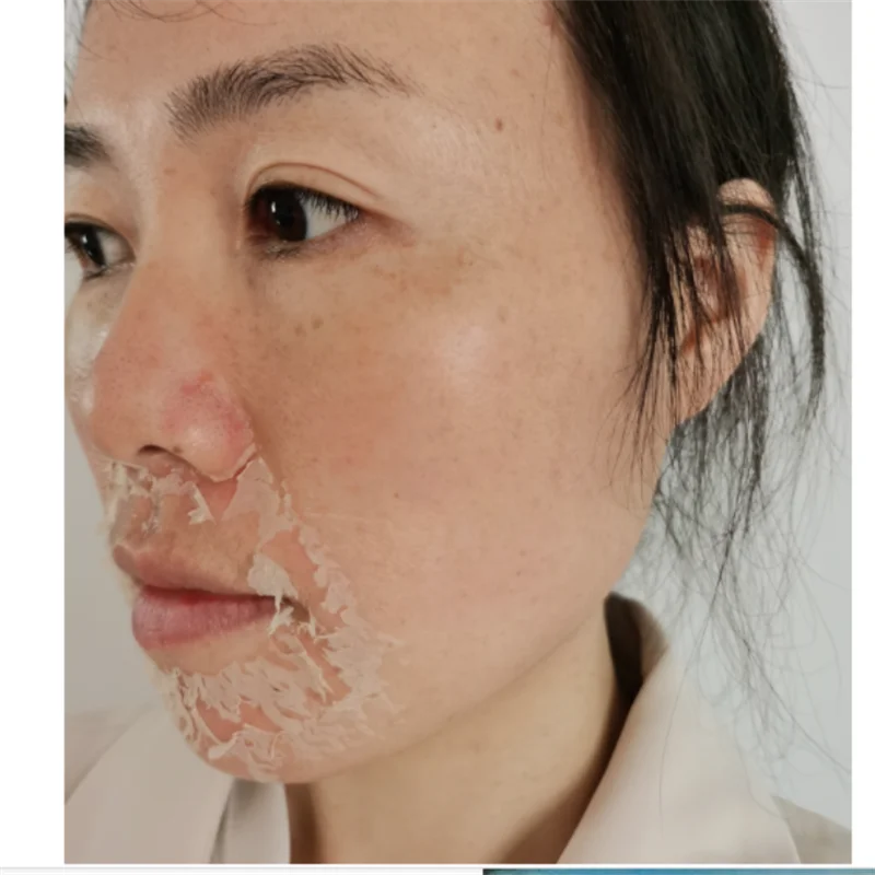 Hot Sale 70% Algae Facial Peel Off Face Mask Spongilla Spicules Peeling Powder Acne Natural Seaweed Extract