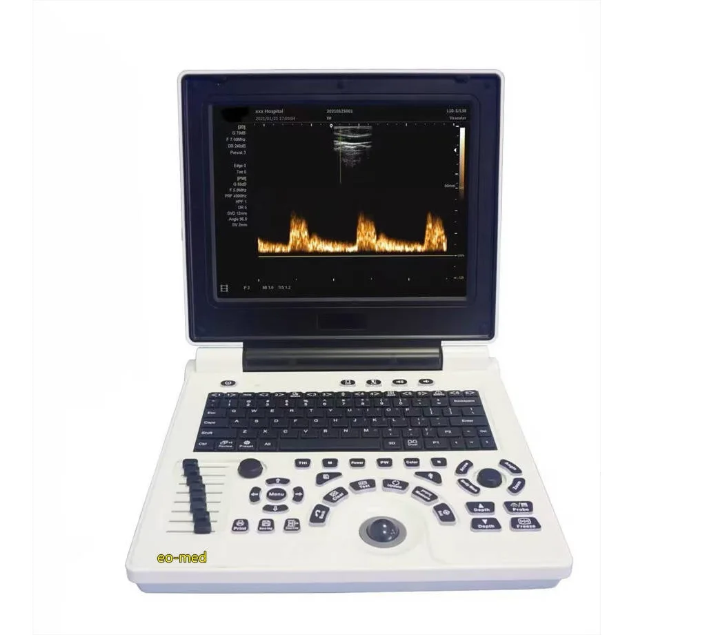 HD display Ultrasound machine Medical Ultrasound Equipment Notebook Ultrasound system BW20 With Optional 3D Image BW20