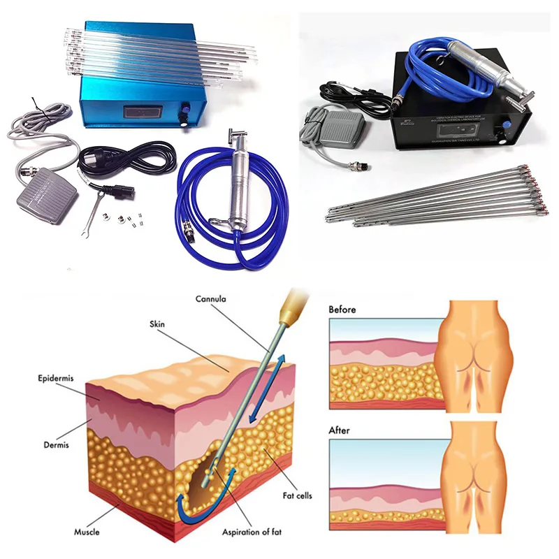 Liposuction Vibration Liposuction Vibrolipo Unit For Plastic Surgeon Assisted Liposuction