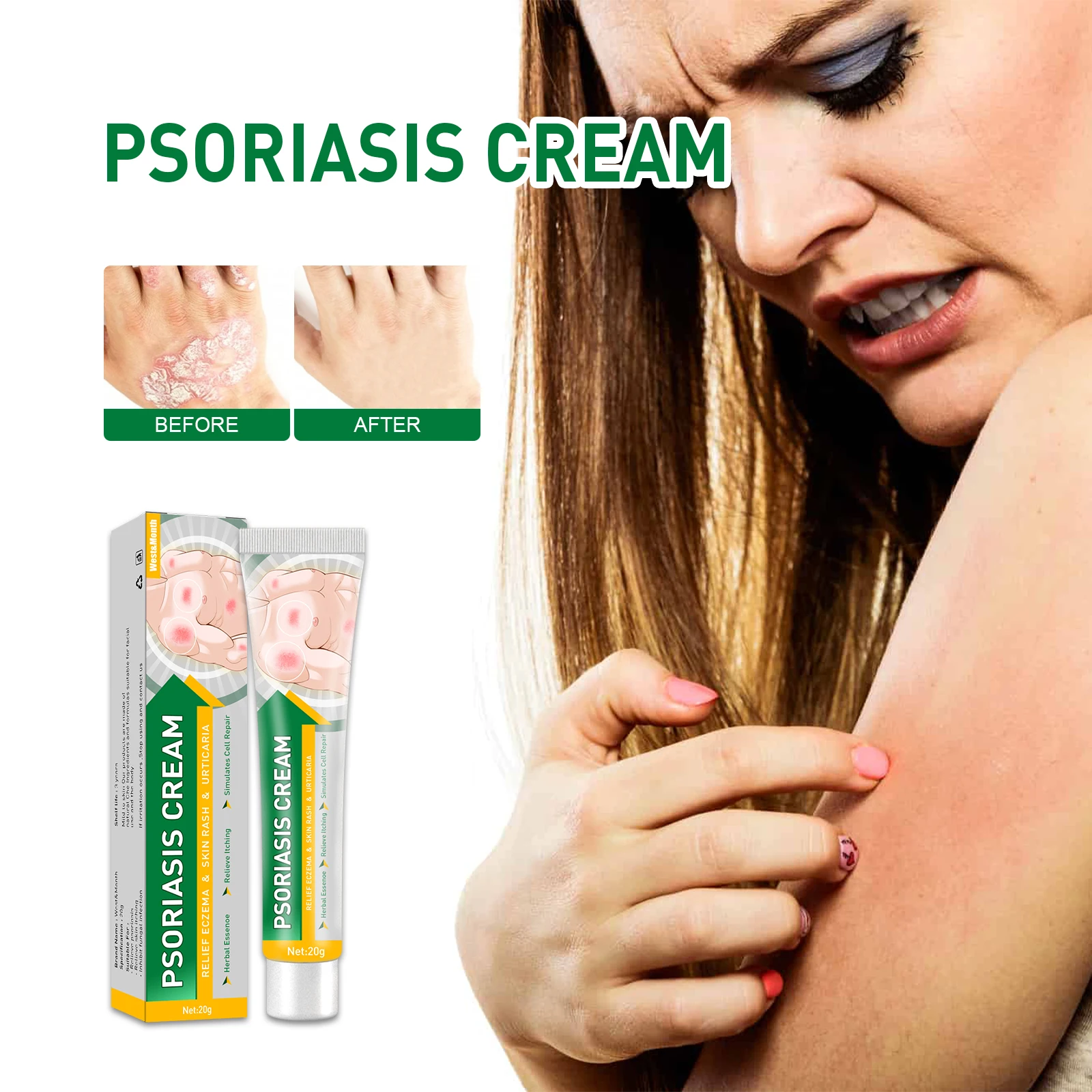 Custom logo Herbal Bacteriostatic Cream Psoriasis Dermatitis Ointment Anti-itching Skin Problems Antifungal Cream