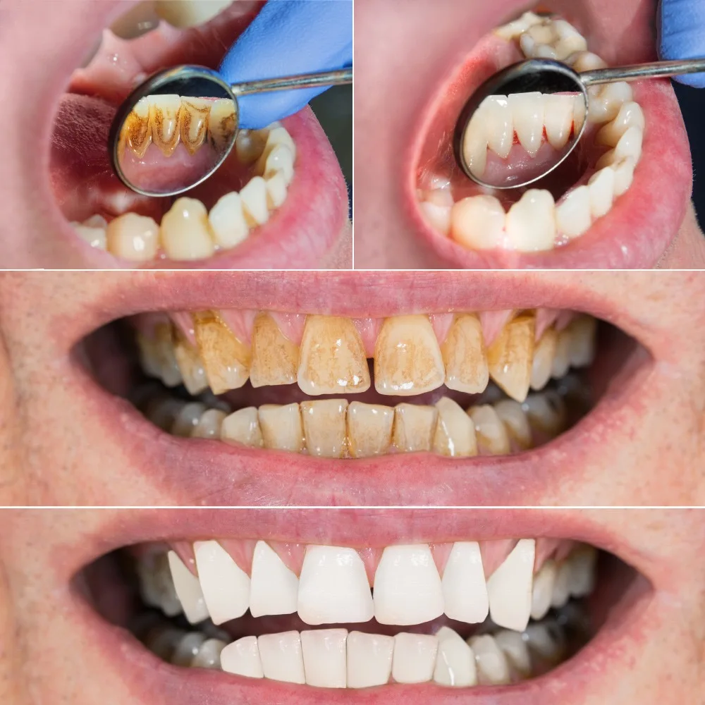 2 In 1 New IPX7 Waterproof Portable Oral Irrigator Dental Waterpik Rechargeable Water Flosser Jet Electric Toothbrush for Travel