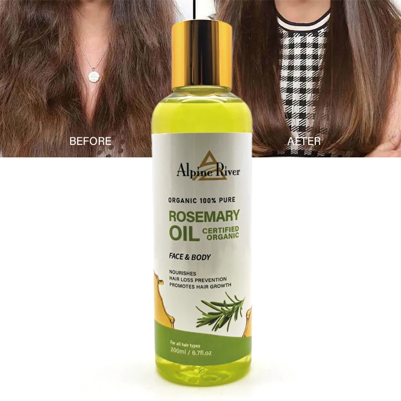 Private label 7 Day Fast Hair Growth Oil Rosemary Growth Hair Treatment Anti-Hair Loss Male Female Repair Oil