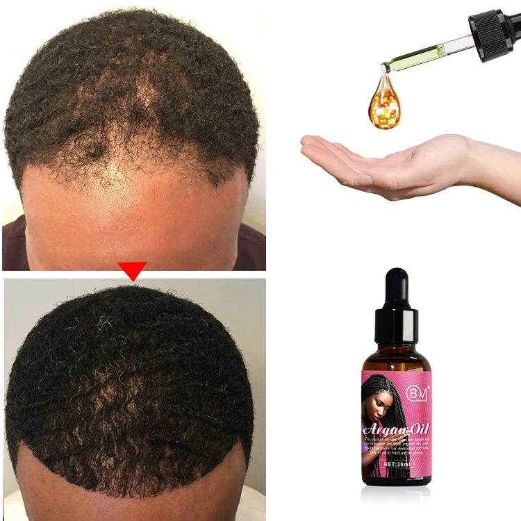 Best china hair growth oil custom logo pure  for men woman