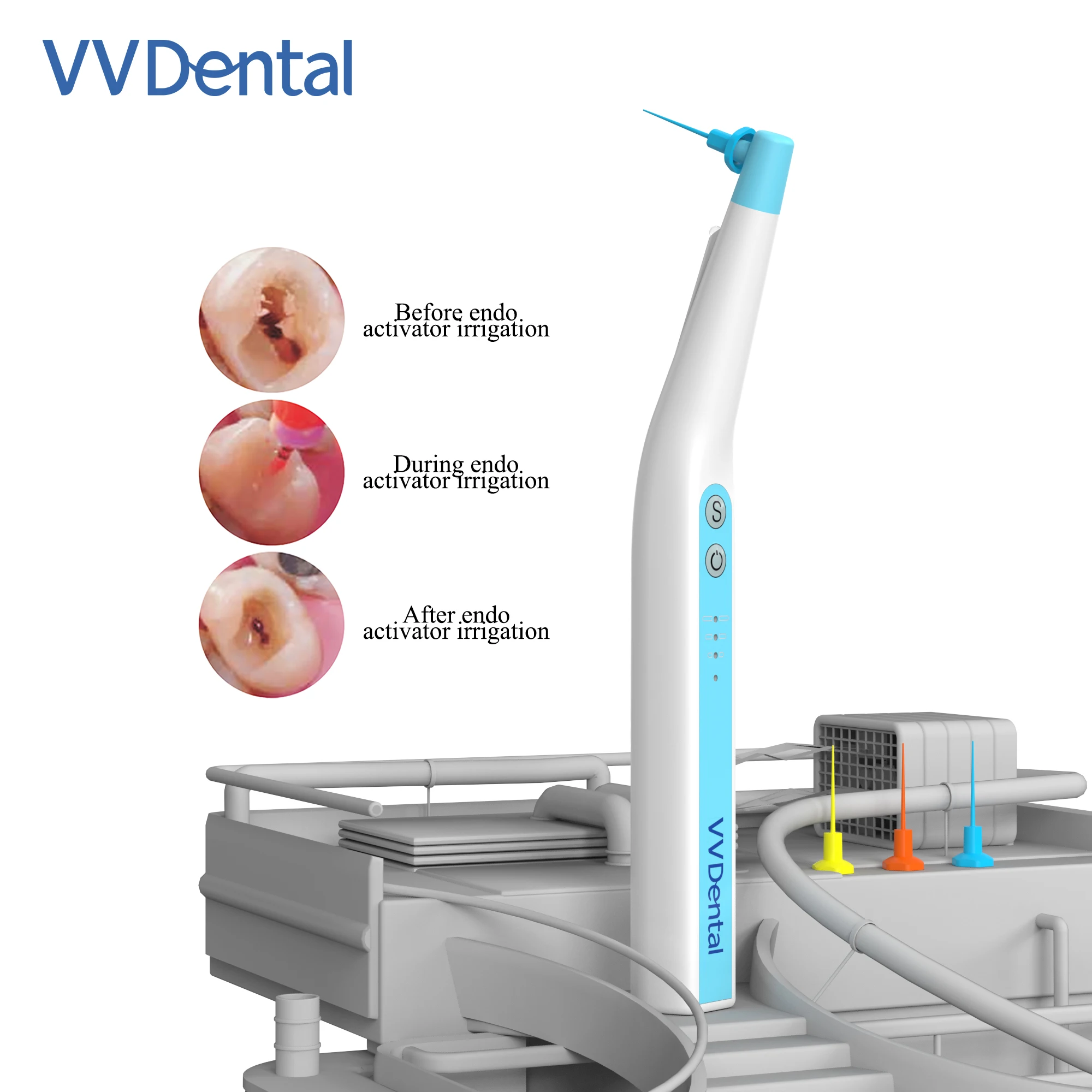 Cheap Dental Equipment for Tooth Treatment Root Canal Irrigator Sonic Endo Activator Endo Activator Sonic Irrigator
