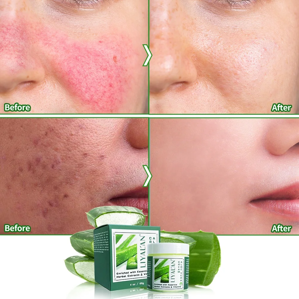 Vegan Organic Anti Aging Aloe Cream After Sun Repair Soothing Moisturizing Whitening Aloe Vera Face Cream