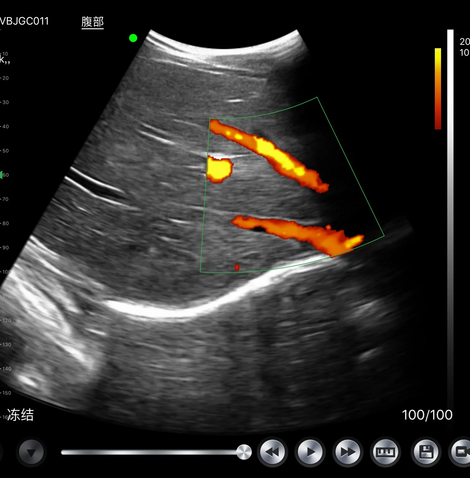 
Newest Wifi 5G Color Doppler Ultrasound Scanner Examinable abdomen Mini Ultrasound Probe 