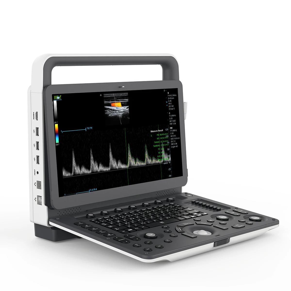 Ультразвуковой аппарат MSLPortable Doppler по лучшей цене ультразвуковой сканер 4D для больницы или клиники