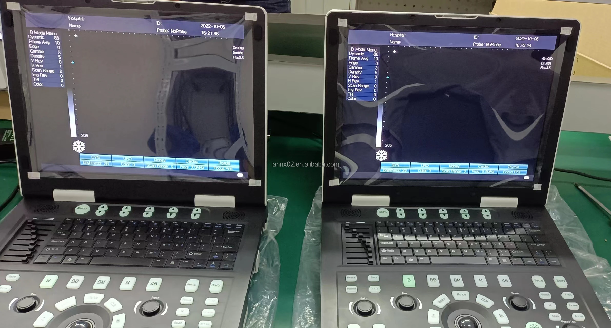 LANNX uRason E2 Clinic Handheld Ultrasound imaging detector Machine echocardiography for GYN/OB use examination scanner USG