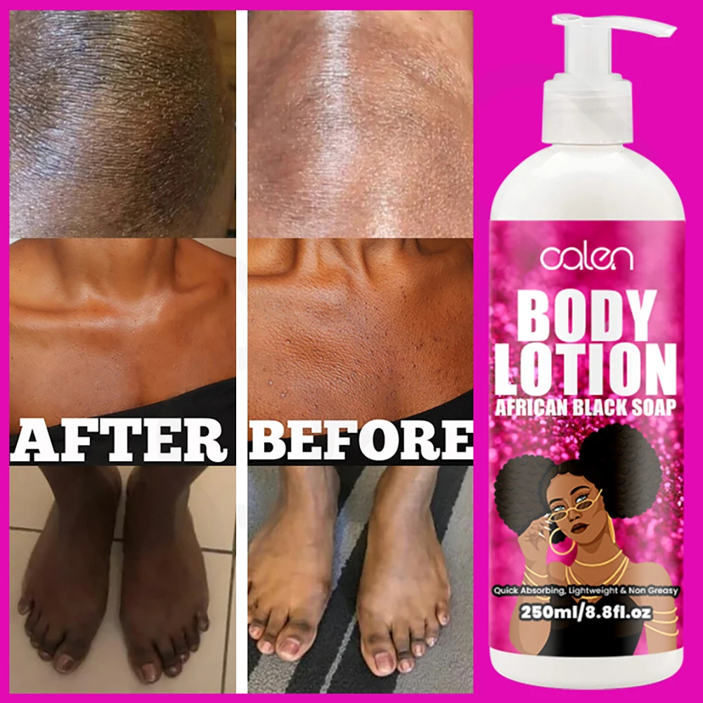 Oalen 250Ml Customized Repair Skin Care Body Whitening African Black Soap Nourishing Lotion