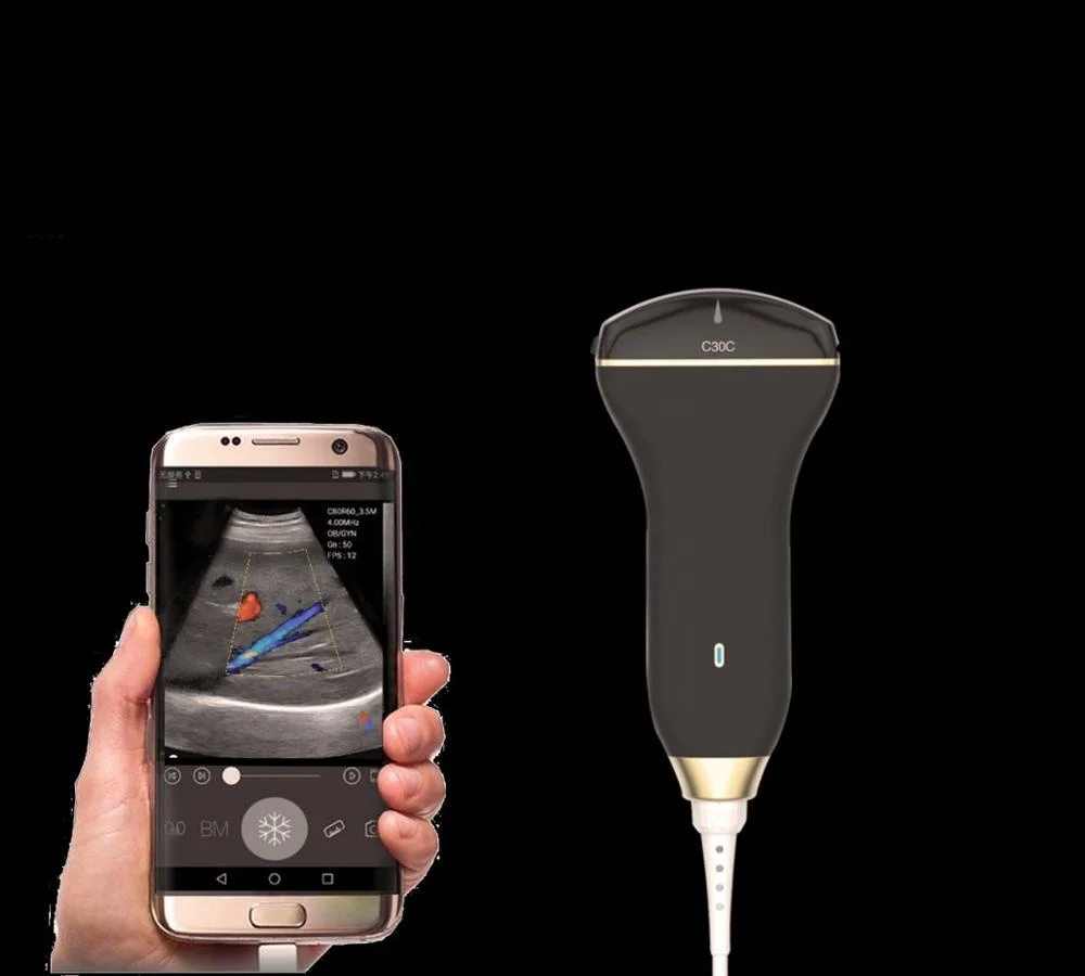 Недорогой цифровой Ручной USB-ультразвуковой зонд для ноутбука беспроводной Wi-Fi-ультразвук