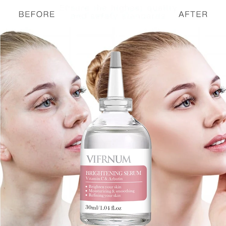 Salicylic Acid private label 30ml sodium hyaluronate skin brightening facial glow serum whitening arbutin vitamin c serum for skin lightening Acne