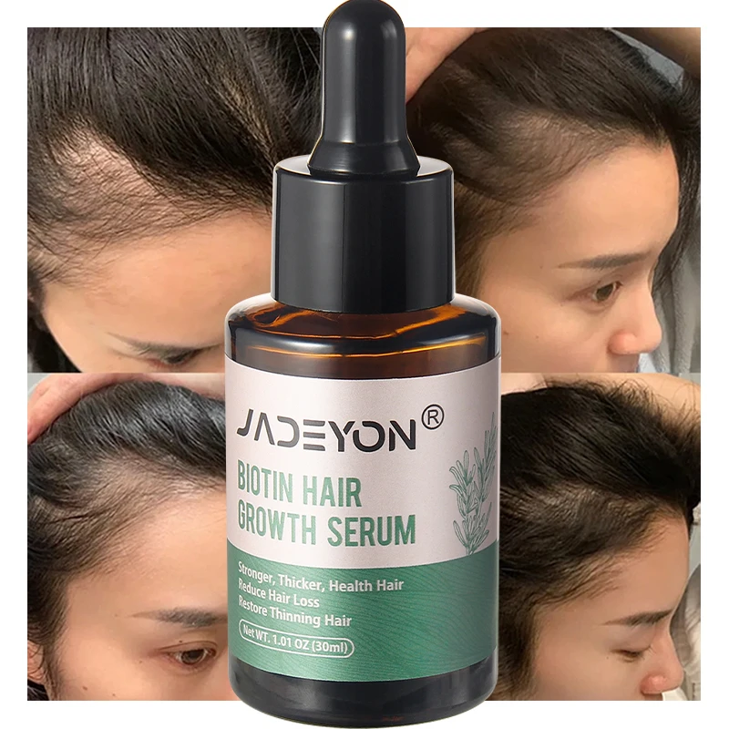 Private Label Natural Castor Oil For Hair Serum Anti Loss Regrowth For Bald Rosemary Oil Treatment Biotin Hair Growth Serum Oil