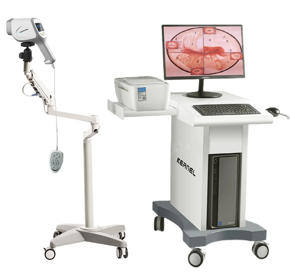 Kernel KN-2200A Video Colposcope Kernel Digital Video Colposcope Camera For Gynaecology Digital Colposcope