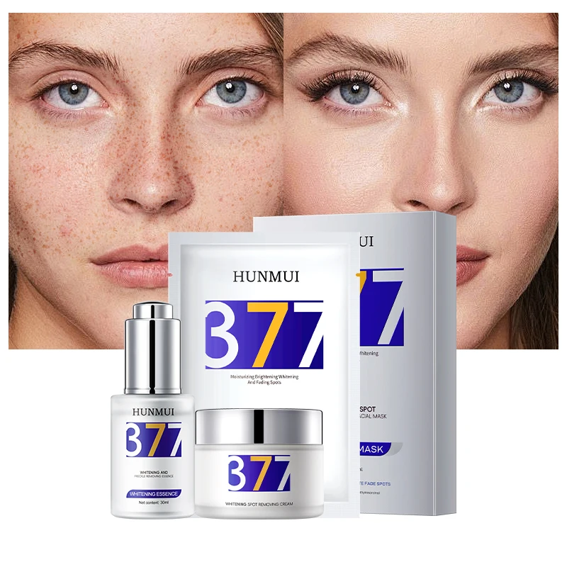 377 whitening and freckle cream use for Strong Effect 7 days dark spot whitening freckle face cream 3piece set