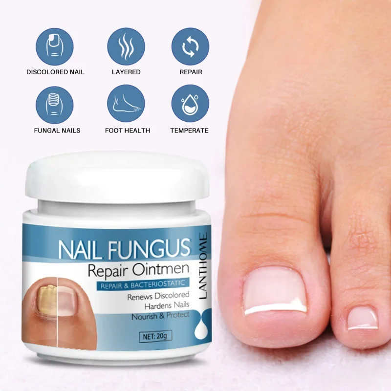 OEM Nail Onychomycosis Fungal Treatment Foot Cream Fungus Removal Cream Paronychia Anti Infection Nails Fungus Repair Ointment