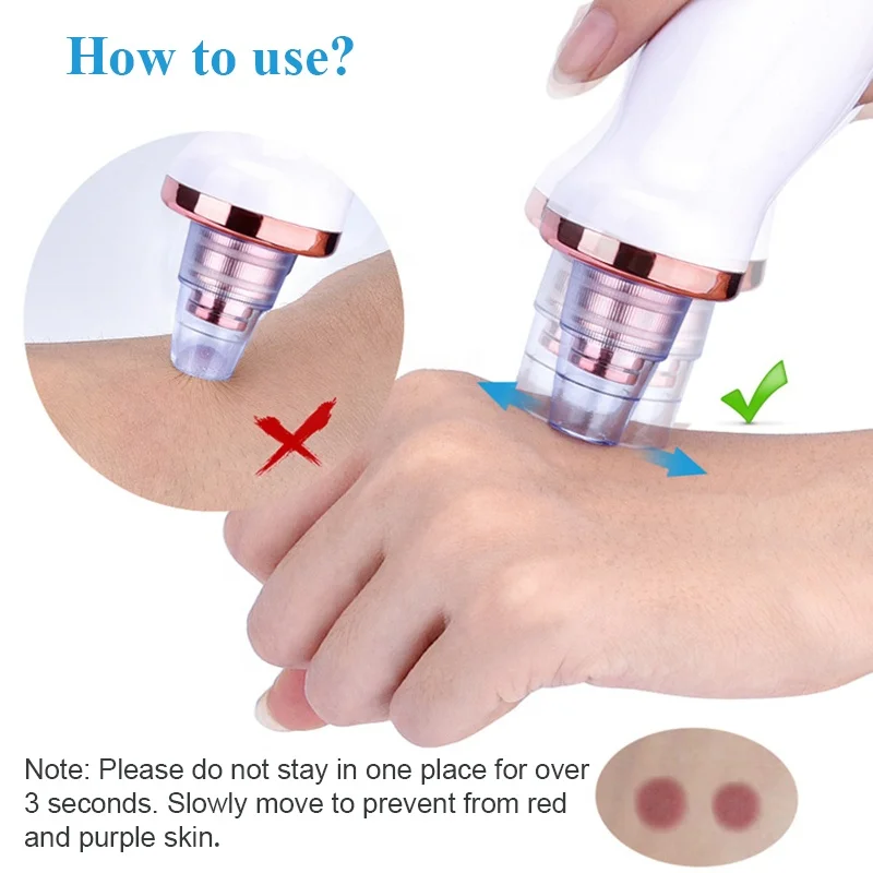 Electric Facial Nose Pores Cleaner Blackhead Vacuum Rechargeable Blackhead Remover Vacuum Pore Cleaner