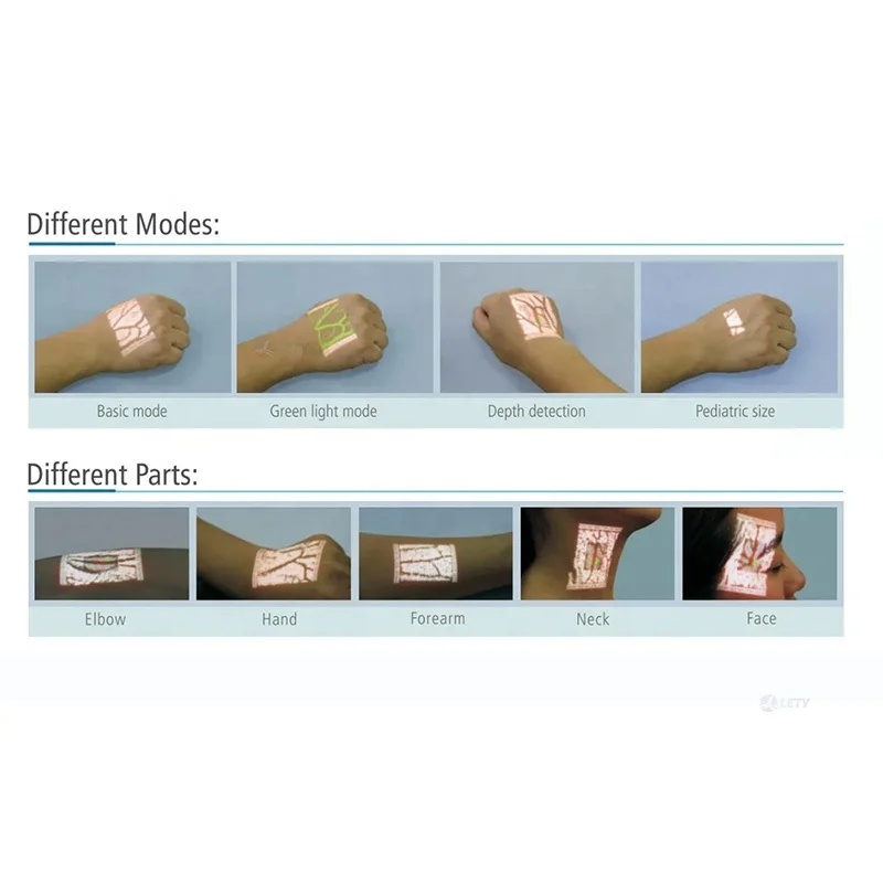 Factory Price Portable Medical Infrared Vein Viewer Finder Machine For Finger Vascular Blood Detector Vascular Imager