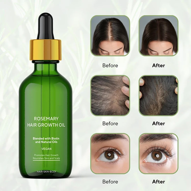 Private Label 100% Natural Organic Rosemary Castor Almond Oil Men Women Scalp Care Serum Hair Treatment Growth Oil