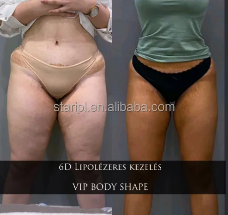 Painless 6D lipolaser laser 635nm 650nm red light therapy 780nm 980nm fast slimming treatment weight loss body sculpture machine