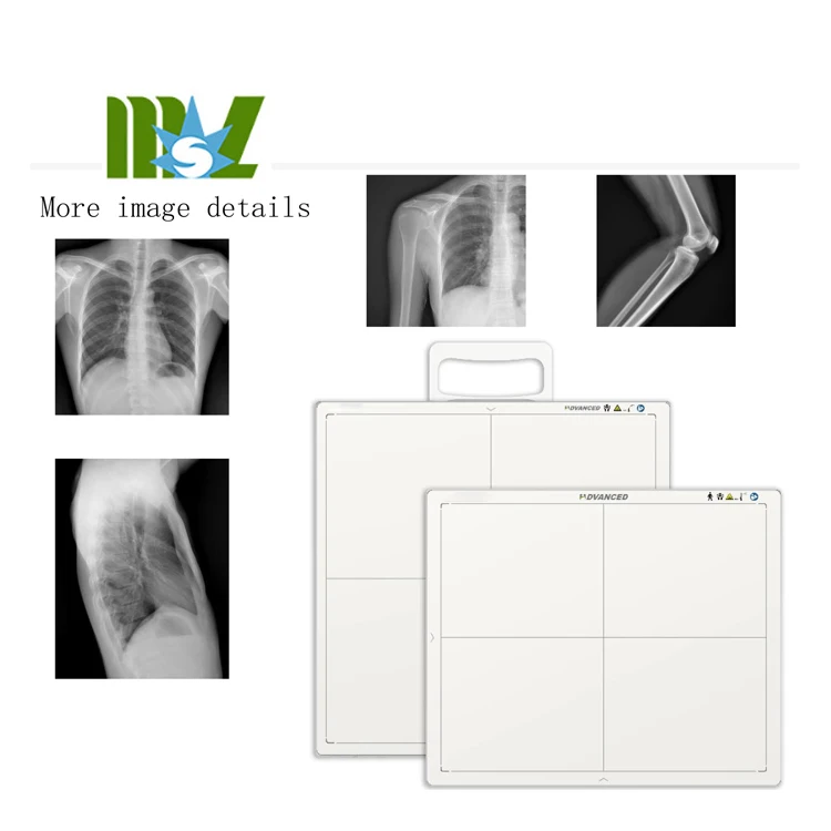 Factory Price Mars 17*17 X-ray Wireless Flat Panel Detector DR for Human and Animal