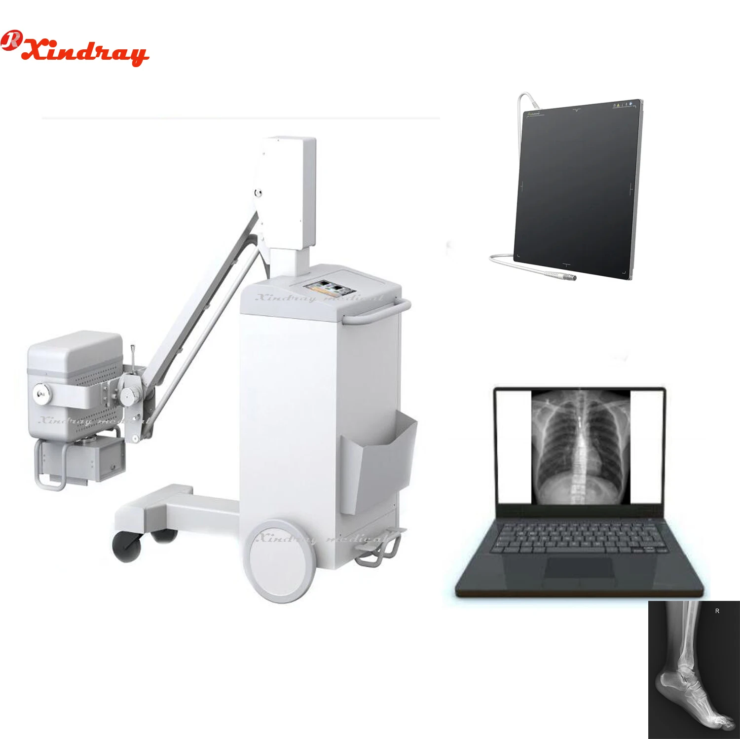 High Frequency 150MA X ray Mobile Machine with panel Laptop Software with  X-ray generator for Imaging