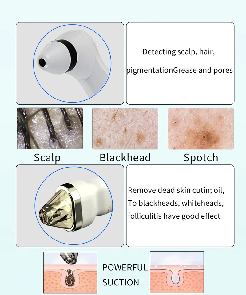 AU-968B Scalp Care Anti-hair Loss Machine Scalp Analysis Treatment Hair Growth Therapy Machine For Hair Clinic Spa Salon