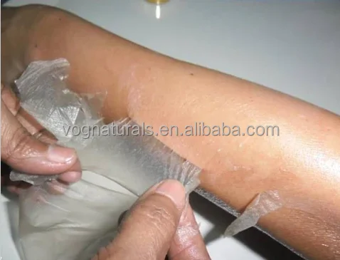 before and after 2.png