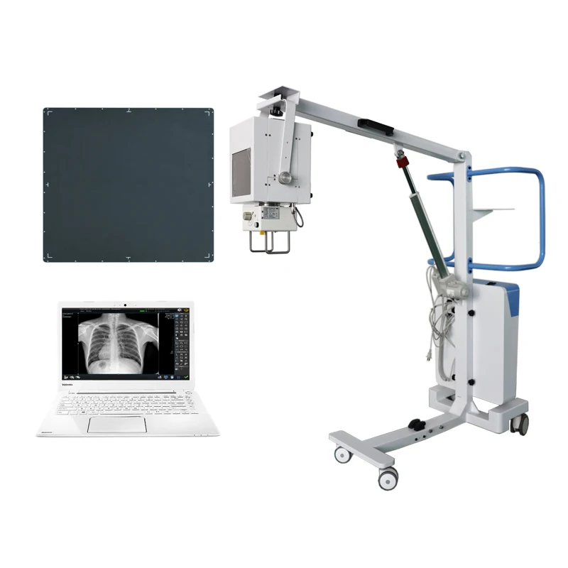 Cheap price available for hospital filming x ray digital x ray machine portable medical