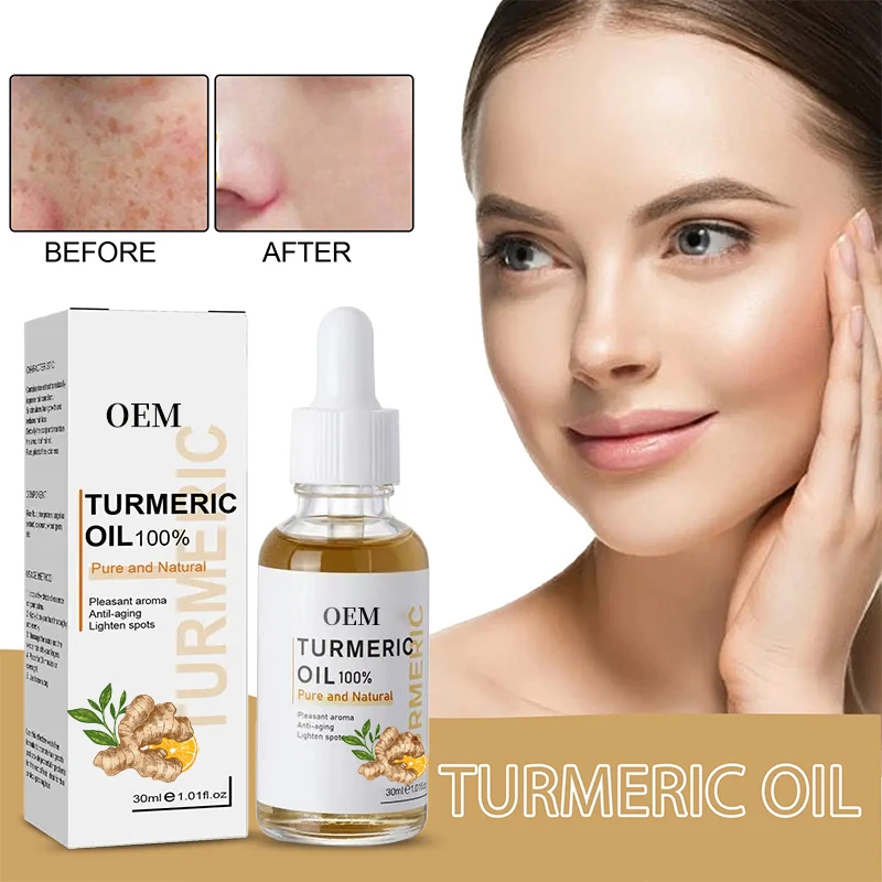 New Turmeric Essence Facial Essence Anti-Aging and Acne Mark Fade with Ginger Pure Essential Oil Gently Moisturizing Skin