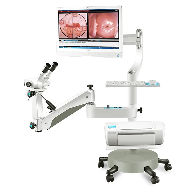 Kernel Optical Colposcope High Quality Optical Colposcope All-in-one Design Video Colposcope for Gynecology