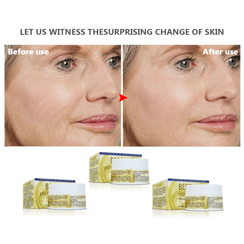 Vitamin B5 Repair Cream Panthenol Skincare Products Moisturizing Soothing Acne Redness Face Moisturizer Cream Lotion
