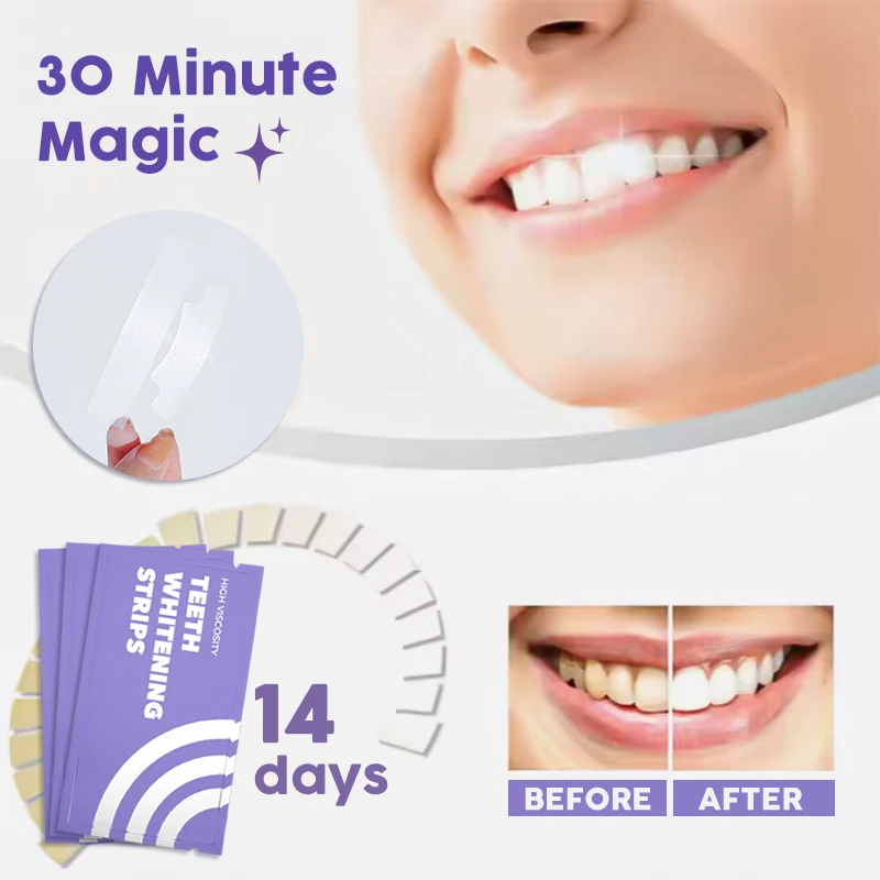 Wholesale Teeth Stain Remover Daily Use Dental Whitening Teeth Strips Pap Teeth Whitening Strips 28 Private Logo