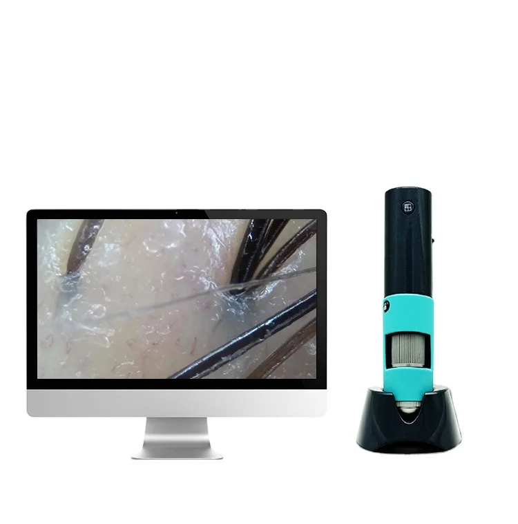 Portable Wireless Wifi Scalp Camera Detecting Hair Follicles, Hair Cameras Wireless wifi connection for mobile tablet