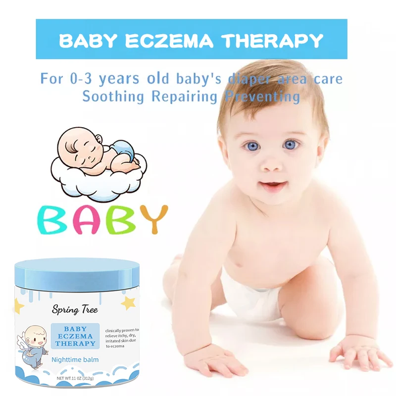 OEM ODM полноэффективный Восстанавливающий детский подгузник лечение сыпи псориаз хороший крем от экземы псориаза гербики